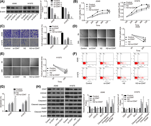 A549 and H1975 cells transfected with si-CD47 or si-NC were treated with 60% H2, then the following assays were performed. (A) Western blotting assay was used to detect the knockdown efficiency of si-CD47 in A549 and H1975 cells. (B) CCK-8 assay was used to detect cell proliferation. (C) Transwell chambers were applied for cell invasion assessment. (D,E) Wound healing assay was used to detect cell migration ability. (F,G) The effects of H2 treatment on the apoptosis of A549 and H1975 cells were determined by flow cytometry assay. (H) Western blotting was carried out to detect the expressions of CD47, CDC42, Bcl-2, cleaved caspase3, caspase3, cleaved PARP and PARP after 48 h of cell treatment with 60% H2 (*P<0.05, **P<0.01 vs. control group; #P<0.05, ##P<0.01 vs. H2 group).