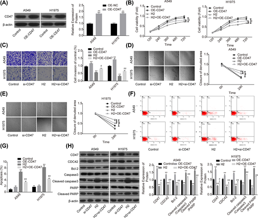 A549 and H1975 cells transfected with OE-CD47 or OE-NC were treated with 60% H2, then the following assays were performed. (A) Western blotting assay was used to detect the protein expression of CD47 after A549 and H1975 cells were transfected with OE-CD47 or OE-NC. (B) CCK-8 assay was used to detect cell proliferation. (C) Transwell chambers were applied for cell invasion assessment. (D,E) Wound healing assay was used to detect cell migration ability. (F,G) The effects of H2 treatment on the apoptosis of A549 and H1975 cells were determined by flow cytometry assay. (H) Western blotting was carried out to detect the expressions of CD47, CDC42, Bcl-2, cleaved caspase3, caspase3, cleaved PARP and PARP after 48 h of cell treatment with 60% H2 (*P<0.05, **P<0.01 vs. control group; #P<0.05, ##P<0.01 vs. H2 group).