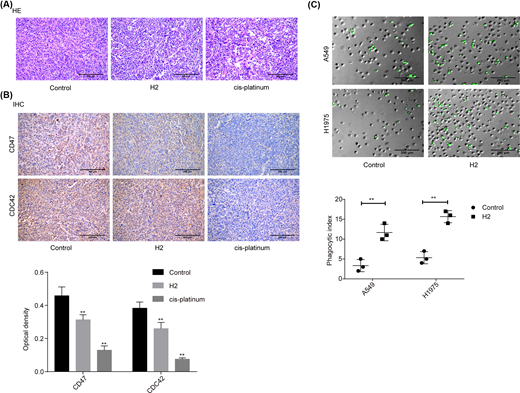 (A) HE staining was carried out to assess the histopathology of lung cancer tissues from different treated mice (scale bar = 200 μm). (B) IHC staining was used to evaluate the expressions of CD47 and CDC42 in lung cancer tissues from different treated mice (scale bar = 200 μm). (C) In vitro phagocytosis assay was used to assess the effect of H2 treatment on macrophage-mediated phagocytosis in A549 and H1975 cells (scale bar = 200 μm) (**P<0.01).